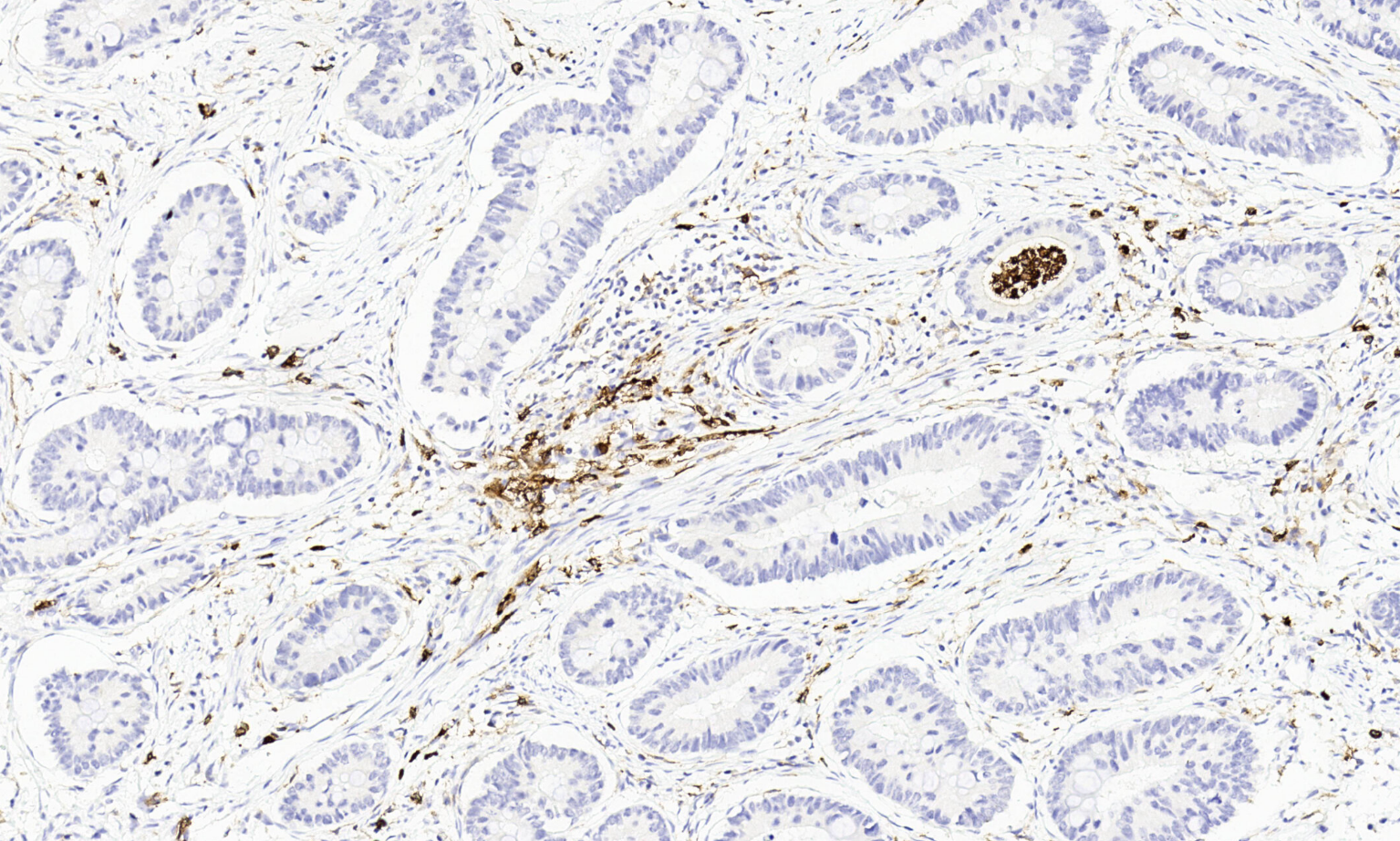 IHC-P - CD11b AD80462-010